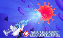 沈阳治牛皮癣的医院：单抗治疗牛皮癣是什么