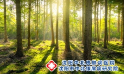 牛皮癣蜕皮是好转还是严重?