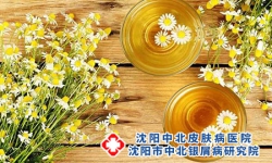 春季成为牛皮癣的高发期的原因