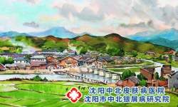 哪些环境因素可以导致牛皮癣的发作?