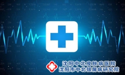 治银屑病没有特效药 ，“规范治疗”才可控制病情!