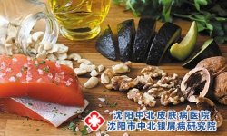 感冒高发季+新冠+甲流，银屑病患者这四种食物少吃!沈阳银屑病医院，沈阳牛皮癣医院，沈阳皮肤病医院