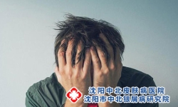 牛皮癣真正的发病原因?