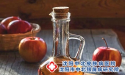 银屑病患者服药治疗期间要避免使用这几类食物!