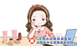 银屑病有哪些种类