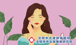 沈阳牛皮癣专家,情绪不好会导致牛皮癣发病