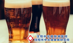 小心啤酒也能诱发牛皮癣 三种坏习惯引发牛皮癣
