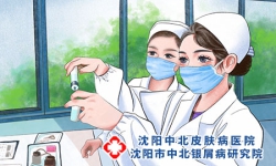银屑病需要免疫检查吗，银屑病与免疫系统的关系
