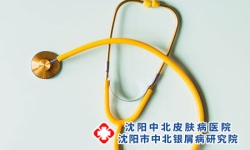 小儿牛皮癣需要注意什么?