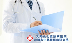 牛皮癣反复发作该怎么控制呢?