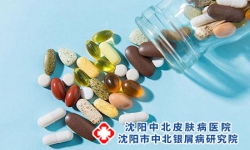 银屑病的三种分期，决定你的病情走向~