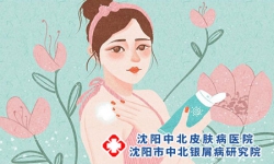 如何防治银屑病?这样做“事半功倍”!
