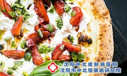 牛皮癣患者应该怎样调理身体-牛皮癣的饮食调理技巧