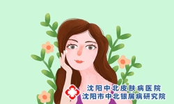 中老年牛皮癣患者的护肤技巧?