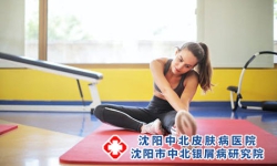 牛皮癣患者应如何保持健康的生活方式?