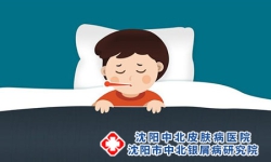 沈阳治疗牛皮癣的医院，青少年牛皮癣怎么护理
