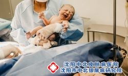 婴儿牛皮癣治疗注意事项-婴儿牛皮癣的治疗方法有哪些呢