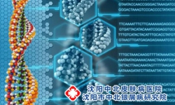 沈阳那个医院看银屑病好点-沈阳银屑病专科医院地址