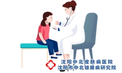 得了牛皮癣如何应对体检?