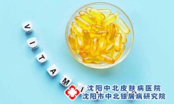 沈阳治疗银屑病医院-关节银屑病怎样好转
