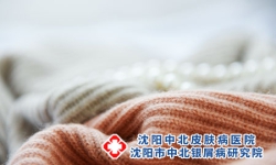 牛皮癣患者冬天不可穿着厚衣服睡觉。