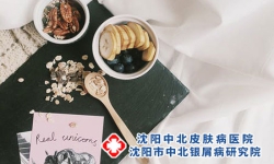 不吃肉的银屑病患者怎么办?