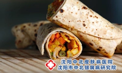 银屑病患者的饮食要怎么吃才能健康呢?沈阳银屑病医院，沈阳牛皮癣医院