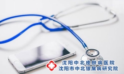 沈阳治牛皮癣十佳医院：怎样可以确诊牛皮癣呢