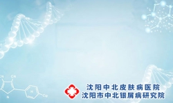 银屑病保湿竟然这么重要!这些你做对了吗?沈阳银屑病医院，沈阳牛皮癣医院
