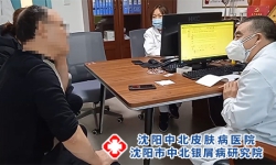 牛皮癣的发病原因分为哪些