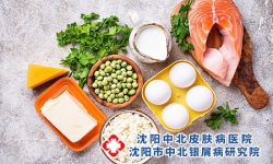 牛皮癣患者需要补充什么维生素?