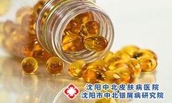 维生素能治疗牛皮癣吗？