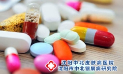 吃牛皮癣的药有哪些？