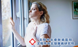 患上牛皮癣-如何抗牛皮癣复发