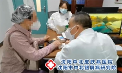 沈阳皮肤科_怎么有效治疗脂溢性皮炎