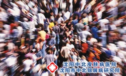 最易患牛皮癣的几大人群？
