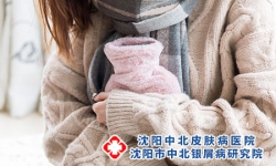 银屑病患者注意如何预防冻疮？