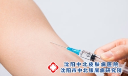银屑病生物制剂每个人都可以打吗