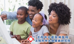 牛皮癣会传染给家人吗 摆正心态及时医治最重要