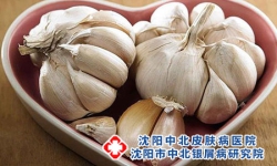 常吃大蒜能治好牛皮癣吗？