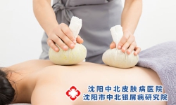 刮痧治牛皮癣的注意事项 刮痧治疗牛皮癣的好处有哪些