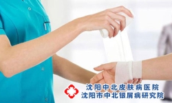 点状牛皮癣鳞屑的银白色光泽是如何形成的?