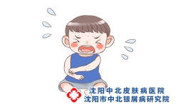 儿童牛皮癣的不同类型以及症状表现都有哪些