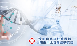 银屑病主要包括哪几种类型，发病过程可以分为几个阶段