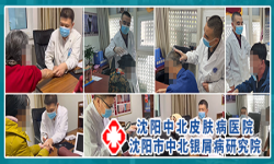 “春季祛顽癣 科学规范查”3月11-12日辽宁省沈阳中北医院大型公益检查援助活动
