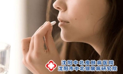 牛皮癣刮痧刺血疗法有哪些 牛皮癣如何预防呢