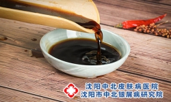牛皮癣患者能吃醋吗?