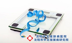 沈阳治疗银屑病专科医院：怎么判断皮肤丘疹是不是银屑病