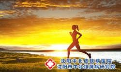 得了牛皮癣之后的护理办法是什么呢?