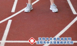 沈阳有没有专业治疗银屑病的医院